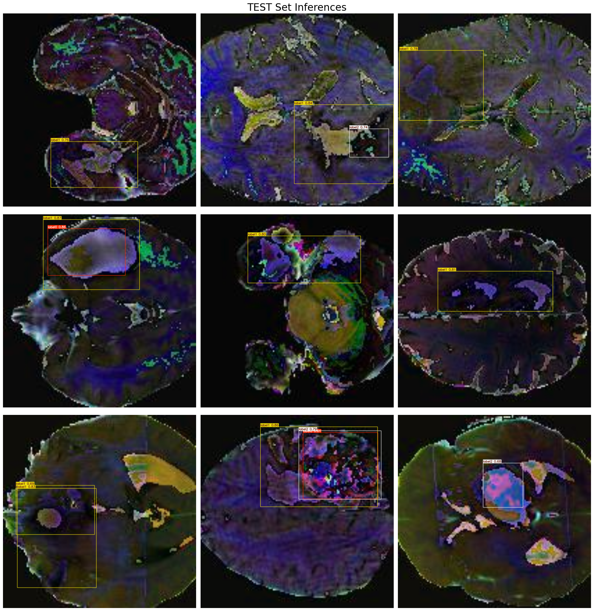 MRI Tumor Detection Model screenshot